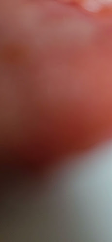 Hook & Ladder Dooradoyle - Limerick